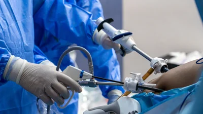 Laparoscopic Surgery